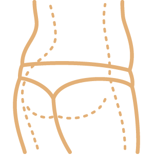 Otoplasty 